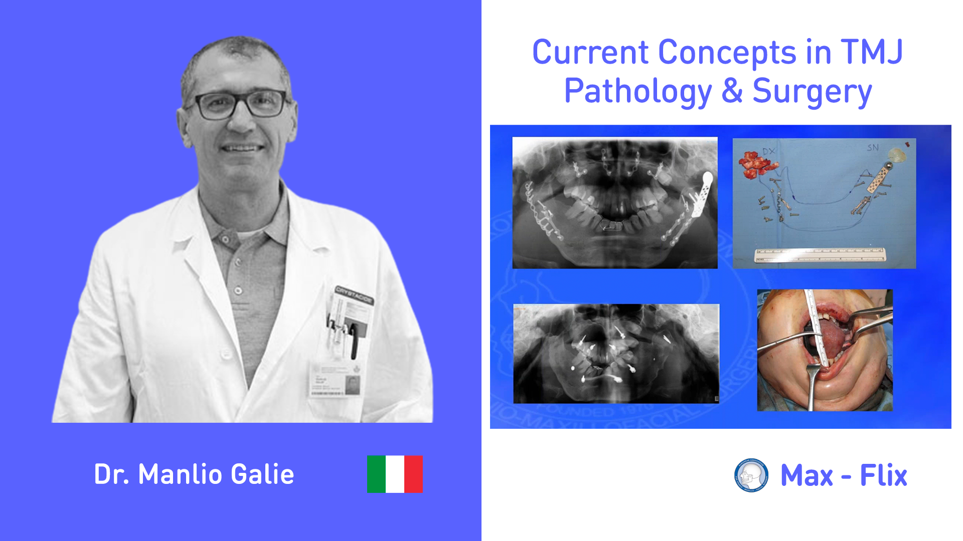 Current Concepts in TMJ Pathology & Surgery