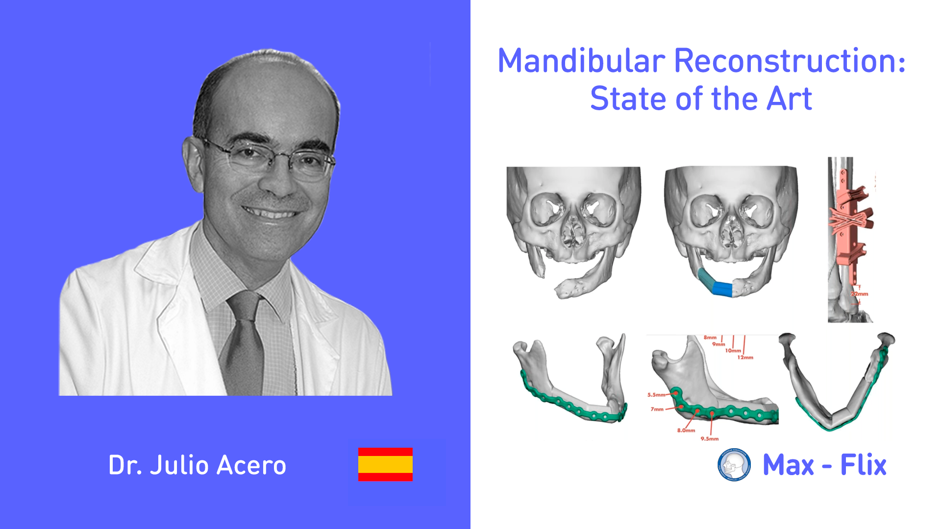 Mandibular Reconstruction: State of the Art